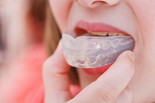 Prevent Dental Mishaps With a Custom Mouthguard